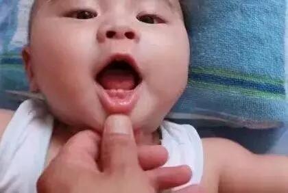 宝宝出牙之前有什么征兆,宝宝出牙前有什么征兆吗