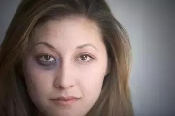 中医如何看眼睛的黑眼圈,黑眼圈重中医怎么解释