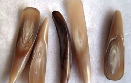 挑痧疗法大全,刮痧疗法挑痧