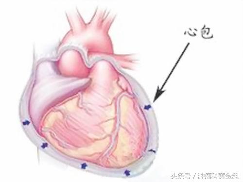 黄金昶治疗脑肿瘤,黄金昶治腹水视频