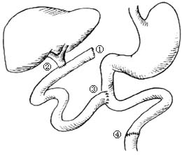 胆囊炎会引起胸闷胸痛吗,胆囊炎和胆结石会引起胸痛吗