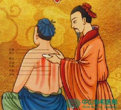 挑痧疗法大全,刮痧疗法挑痧