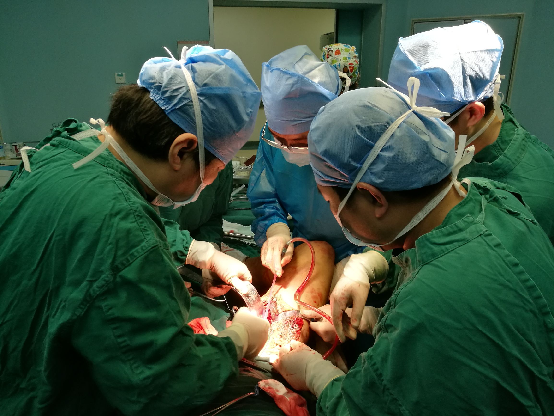 大医精诚，多科强强联手成功救治一例股总动静脉完全断裂患者