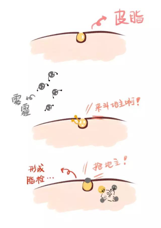 涓嶈姳閽辫繕鏈夋晥鐨勫幓榛戝ご鏂规硶get,娓╁拰楂樻晥鍘婚粦澶寸殑鏂规硶