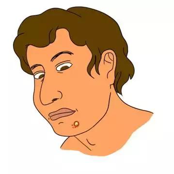 长痘痘的原因你知道有多少,长痘痘的原因你了解多少