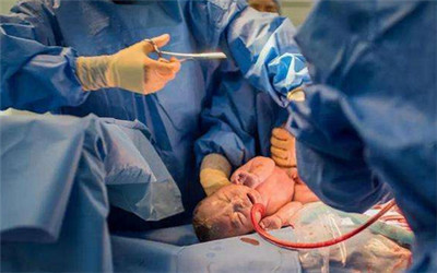 让过来人告诉你剖腹产到底啥滋味,谁说无痛分娩不会腰疼