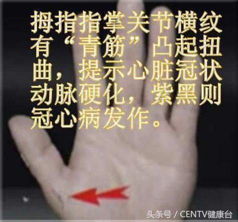 健身一段时间手背青筋明显了,健身乳房上边青筋明显是怎么回事