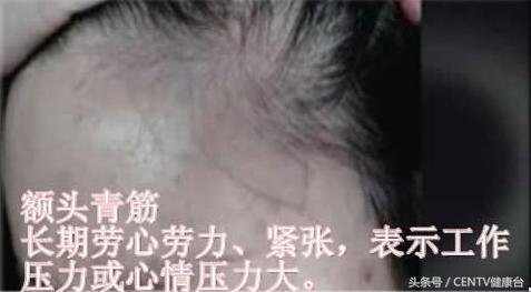 健身一段时间手背青筋明显了,健身乳房上边青筋明显是怎么回事