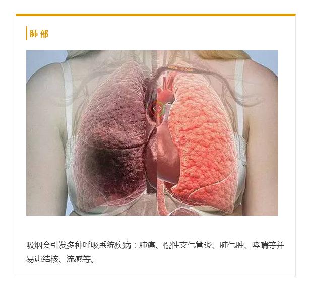 世界无烟日丨当你点燃香烟那时起，你便与魔鬼签写了契约