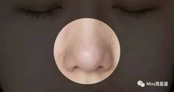 涓嶈姳閽辫繕鏈夋晥鐨勫幓榛戝ご鏂规硶get,娓╁拰楂樻晥鍘婚粦澶寸殑鏂规硶