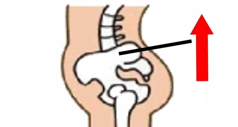 原来身体里面有个“盆儿”他到底有多重要呢?