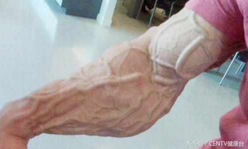 健身一段时间手背青筋明显了,健身乳房上边青筋明显是怎么回事