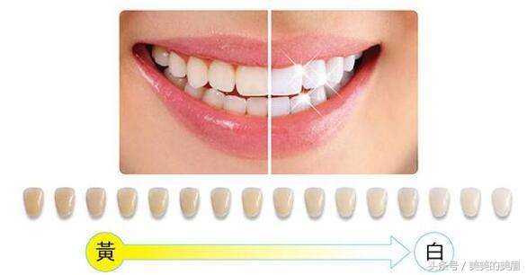 哪种牙齿美白不伤害牙齿,牙齿漂白和牙齿冷光美白