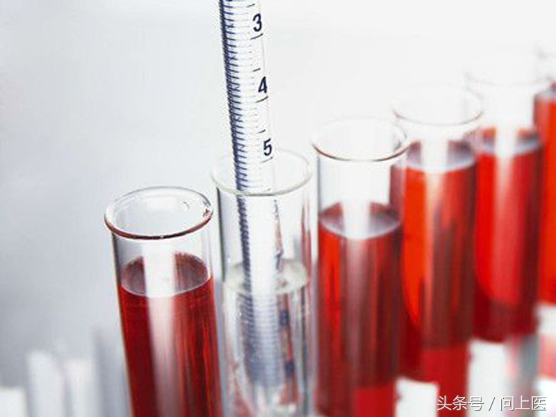 教你看懂尿检单,尿检常识100例