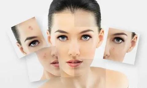 台州消除青春痘疤痕,男士青春痘疤痕怎么修复