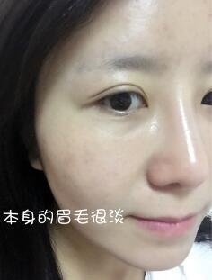 眉毛稀少是否也能种植,眉毛短可以种植眉毛吗