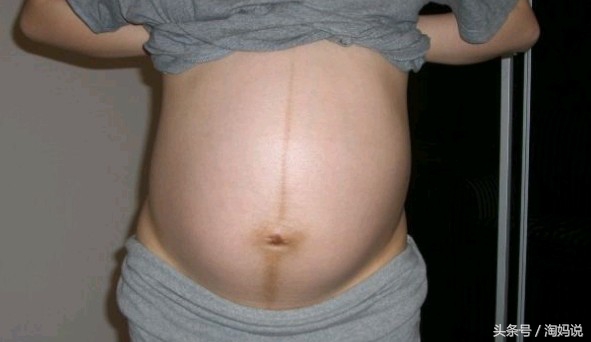 宝宝在妈妈肚子里踢膀胱怎么解决,怀孕期间胎儿总是踢膀胱漏尿