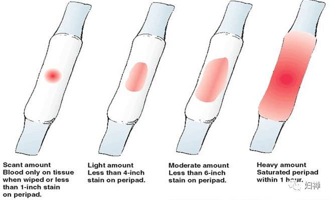 医生告诉你月经过多是怎么回事,妇科医生讲解例假情况