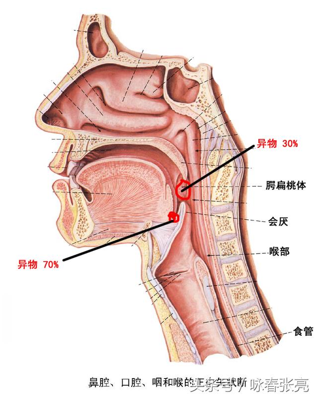 嗓子卡鱼刺医生找不到怎么办,鱼刺卡喉咙医生说吃药