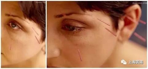 缓解视疲劳红血丝眼药水,缓解视疲劳眼药水推荐