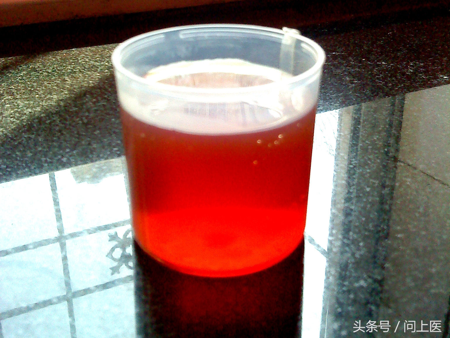 教你看懂尿检单,尿检常识100例