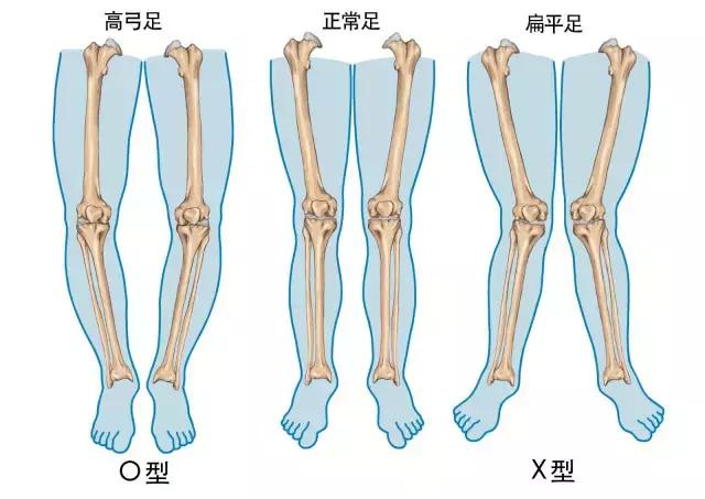足弓和脚后跟痛怎么回事,长期走路脚掌痛鞋垫软还是硬