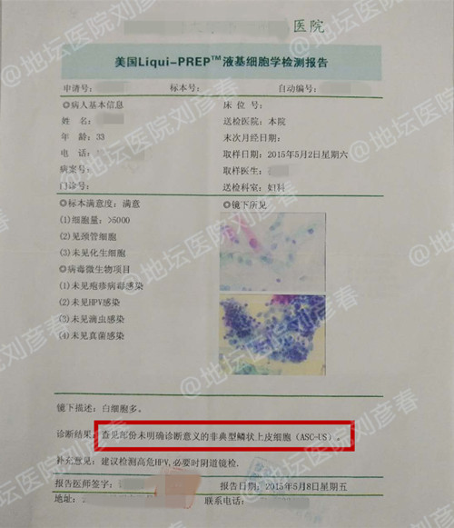 病例分享——宫颈CIN1级的治疗