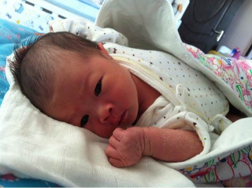 新生儿身上脱皮还会长痘吗,新生儿10天身上脱皮