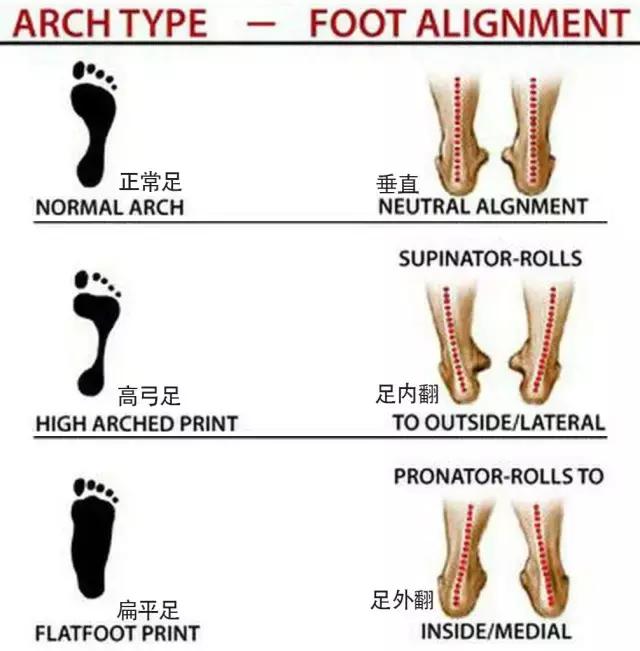 足弓和脚后跟痛怎么回事,长期走路脚掌痛鞋垫软还是硬