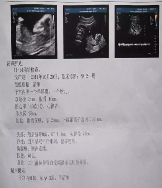 怀孕最重要的时间点是哪一天？