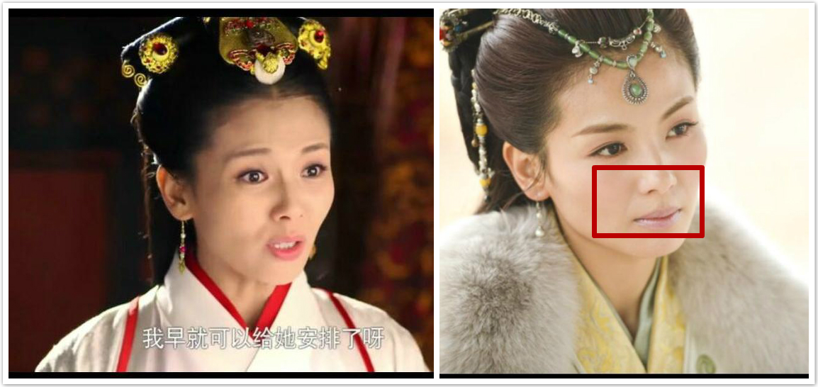 杨紫问怎么去除天生的法令纹！刘诗诗、娜扎也想知道答案啊！