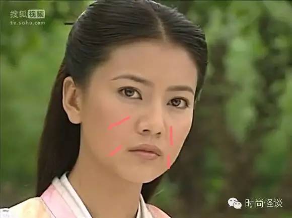 杨紫问怎么去除天生的法令纹！刘诗诗、娜扎也想知道答案啊！