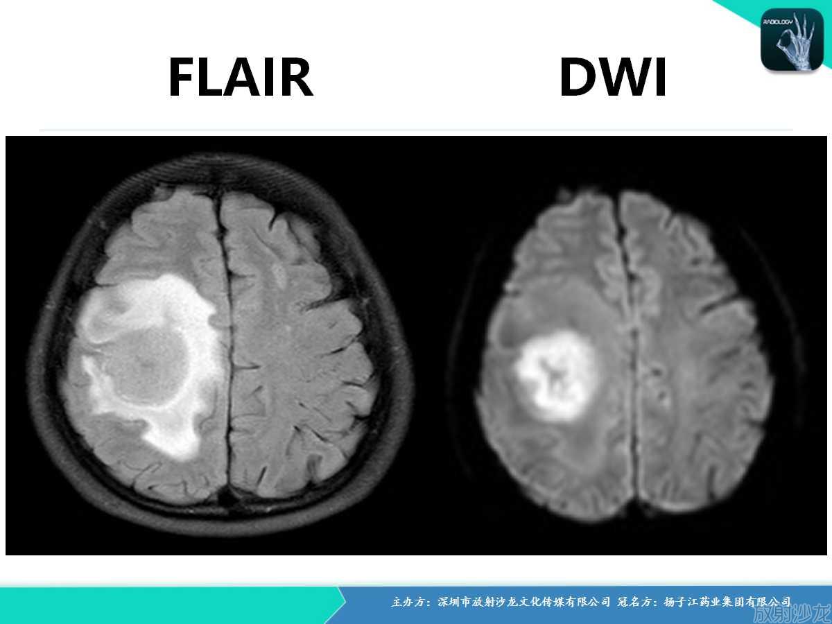 图王争霸赛,图钉拳王争霸赛2011