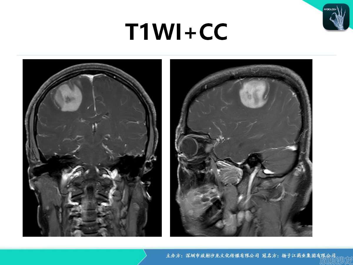 图王争霸赛,图钉拳王争霸赛2011