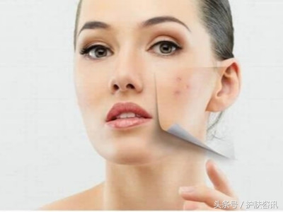 成年人脸上长痘痘什么原因,成年人长痘痘是缺乏营养吗