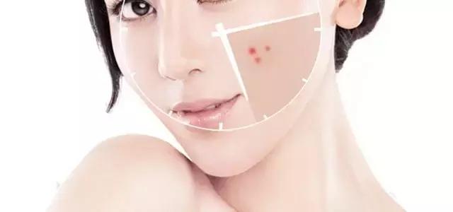 怎么才能把疮给处理干净,如何快速治好身上的疮