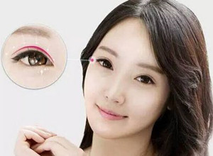 800的双眼皮和8000的双眼皮区别,五毛块钱的双眼皮