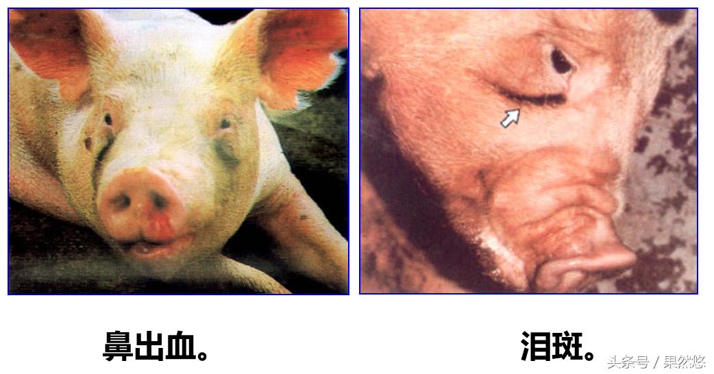 鼻子歪了有什么办法,鼻子歪用针矫正