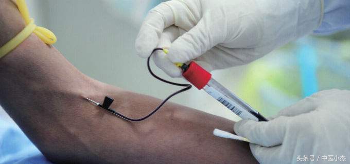 痛风本身不致命是怎么回事,痛风不是很严重应该吃什么药