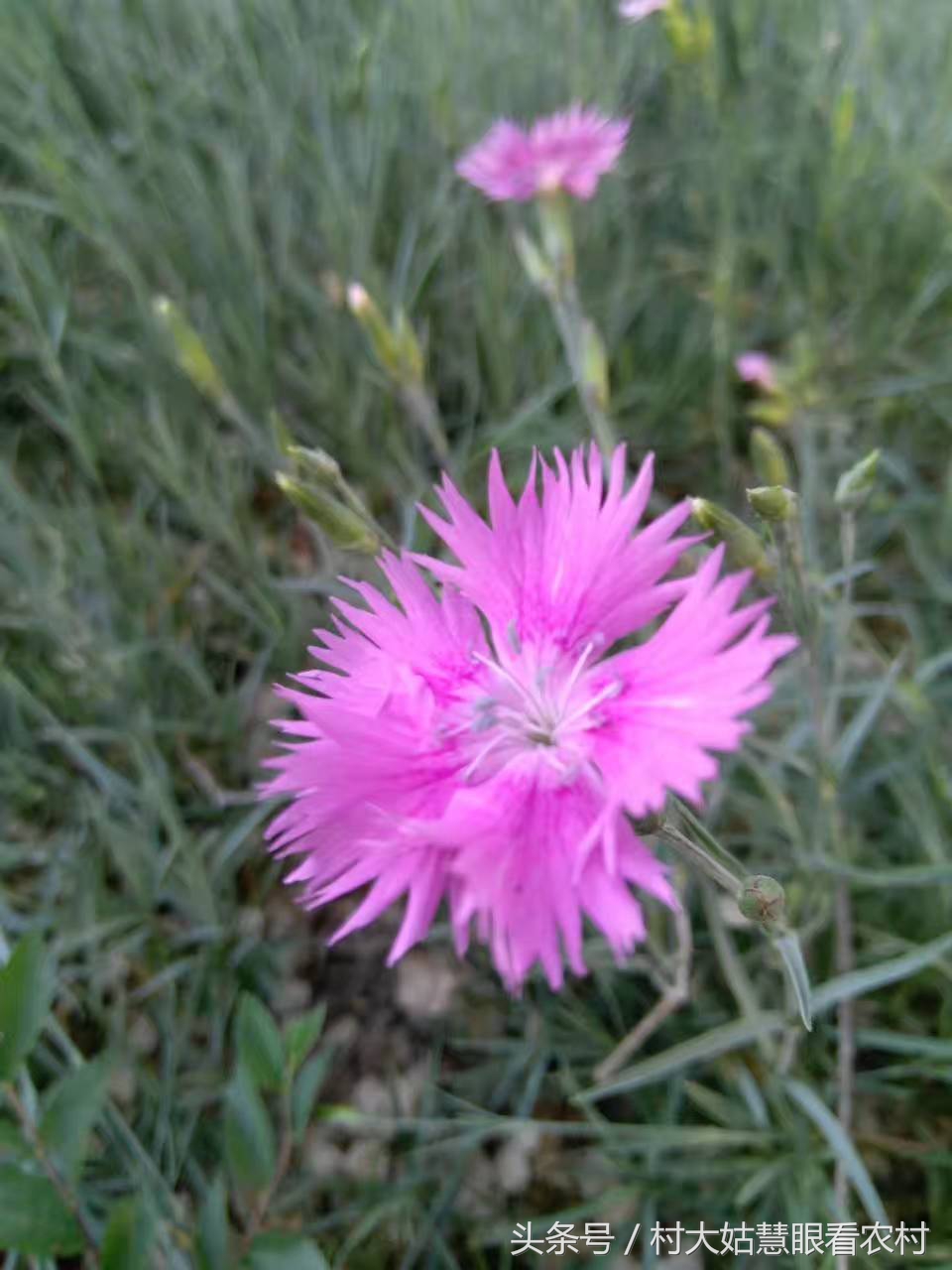住院后的亲身经历,住院经历及感受