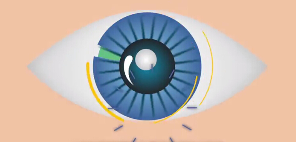 周三说梦:原来“晨勃”居然跟做梦有关!