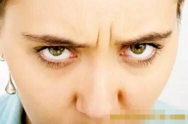 改善川字纹让你年轻,川字纹最好的解决办法