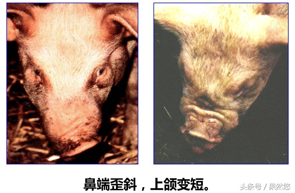 鼻子歪了有什么办法,鼻子歪用针矫正