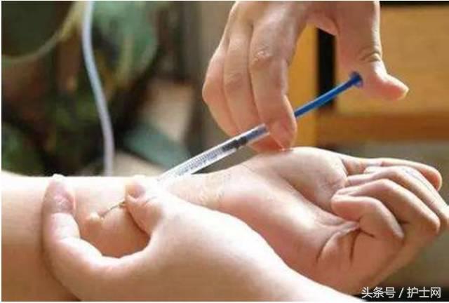 破伤风抗毒素皮试标准是,破伤风抗毒素标准皮试