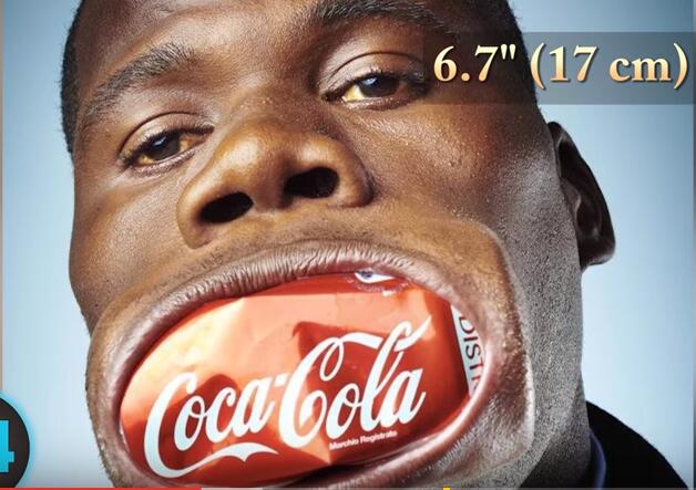 他们才是真正的超人，再大的挫折都挫不到他们，头不全又怎样