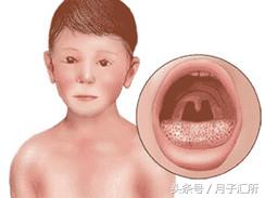 身上都是小红点怎么回事没症状,全身突然起小红点是什么症状