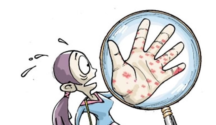 不瘙痒的皮肤病,小心是梅毒哦!