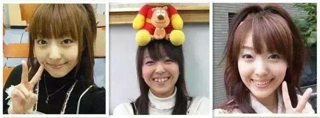 霓虹人民牙齿烂,居然引起了国际讨论背后原因才是父母该重视的