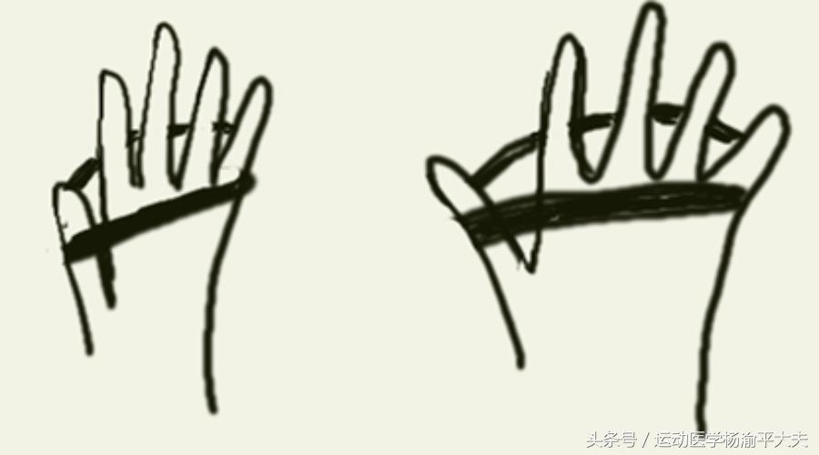 高尔夫球肘康复的思路,高尔夫球肘怎么治疗