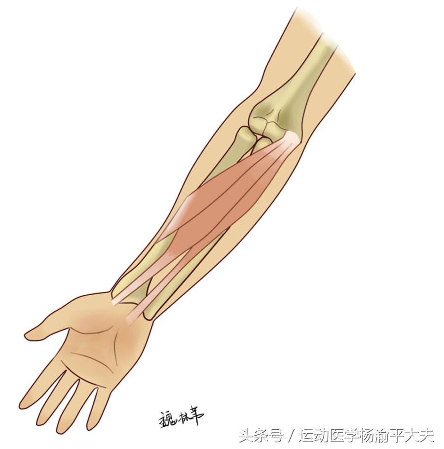 高尔夫球肘康复的思路,高尔夫球肘怎么治疗